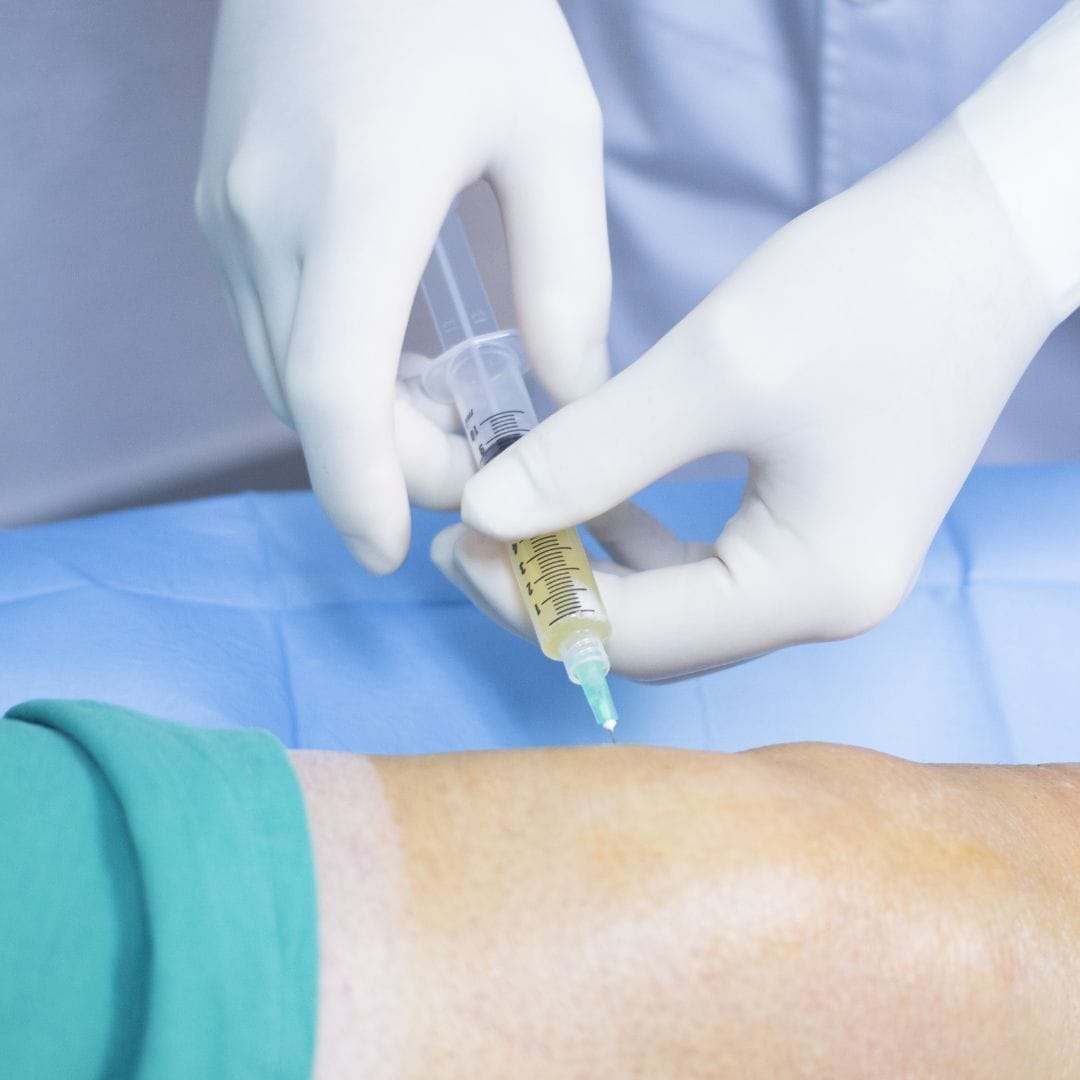 PRP injection procedure and recovery process